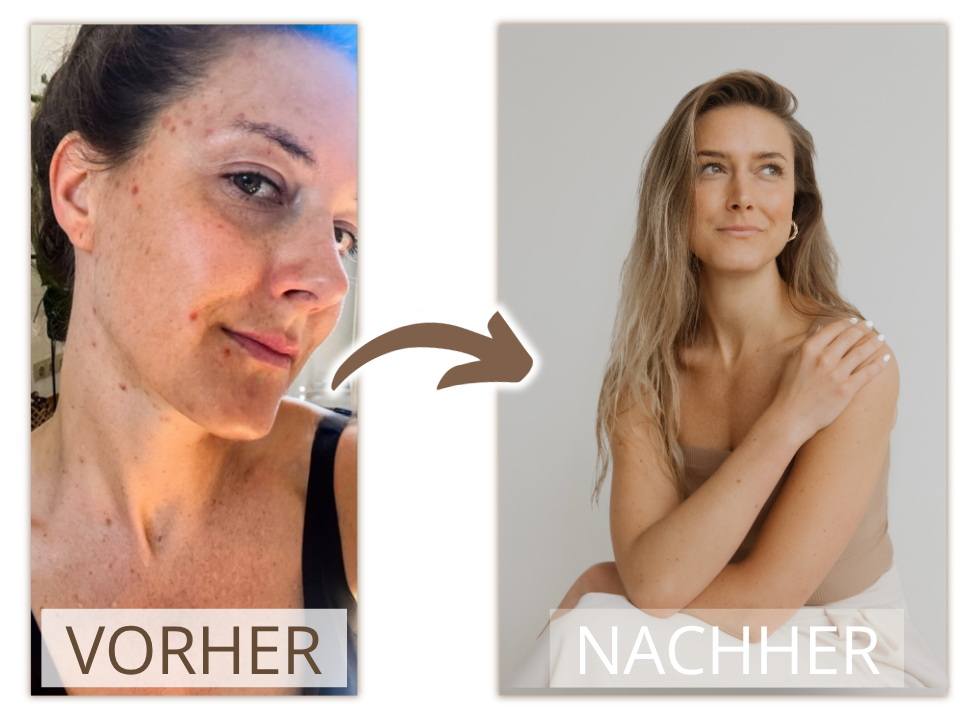Vorher Nachher Vergleich Haut - Bridget Barth - WandelPur - Hautbalance Methode - Online Kurs - Tobias Steinhaeuser
